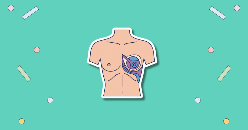 National BRA (Breast Reconstruction Awareness) Day